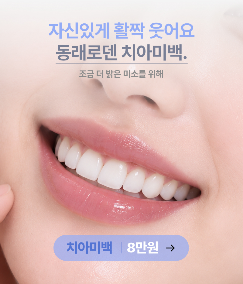 치아미백